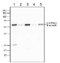V-ATPase, B | vacuolar H+-ATPase subunit B in the group Antibodies Plant/Algal  / Membrane Transport System / Vacuolar membrane at Agrisera AB (Antibodies for research) (AS14 2775)